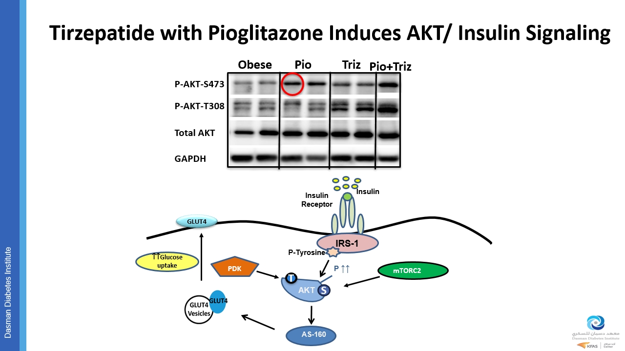 tirzepatide pioglitazone combination Media Centre