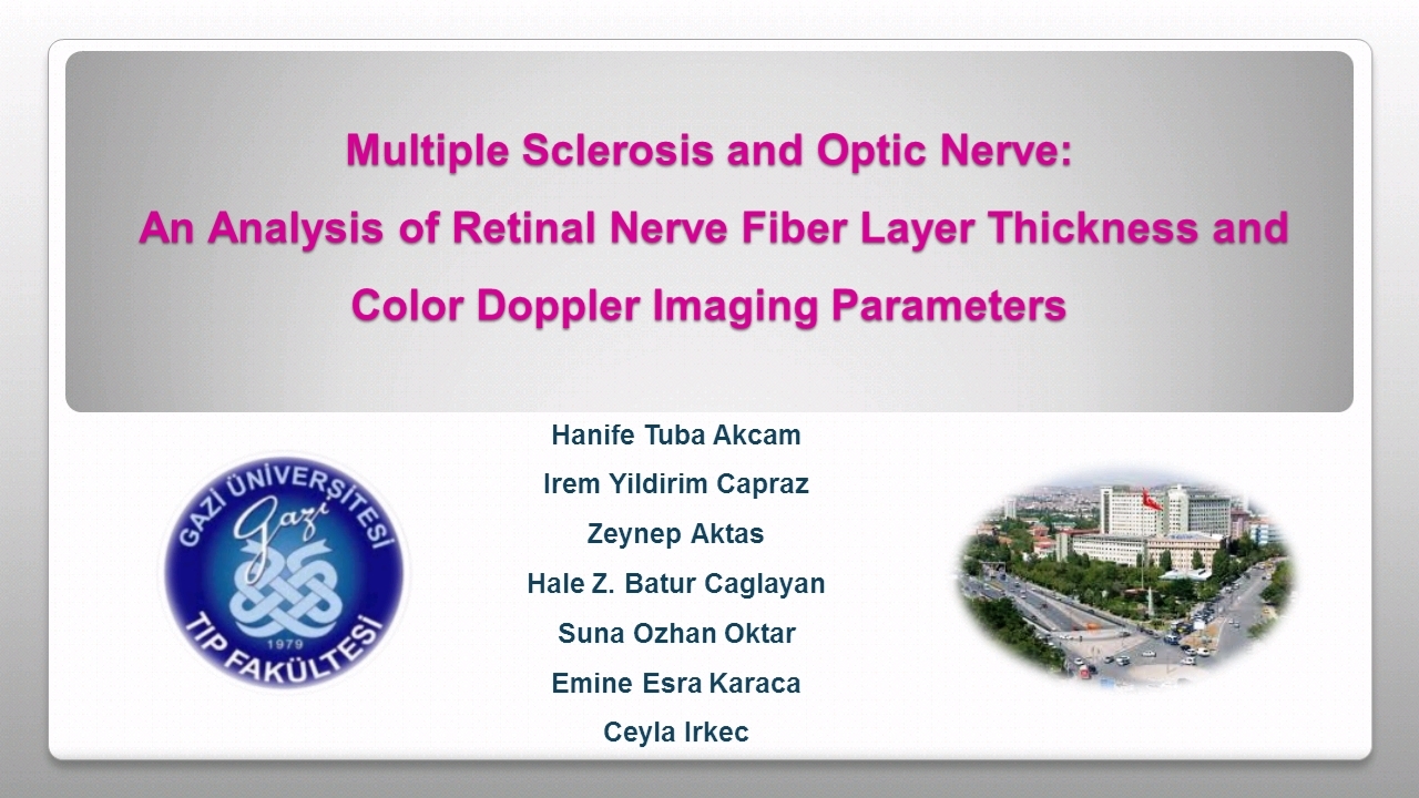 Escrs Ondemand